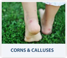 Corns & Calluses - Dr Dan Bank