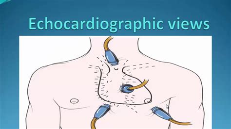 Echocardiography step by step, Dr. Tarek Khairy Mousa - YouTube