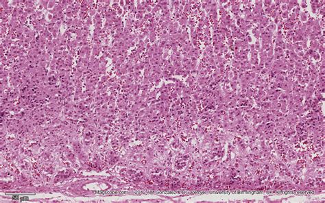 Zona Glomerulosa Histology