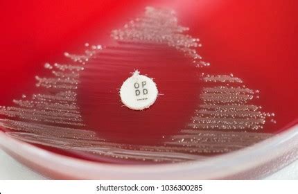 424 Disk Diffusion Images, Stock Photos & Vectors | Shutterstock