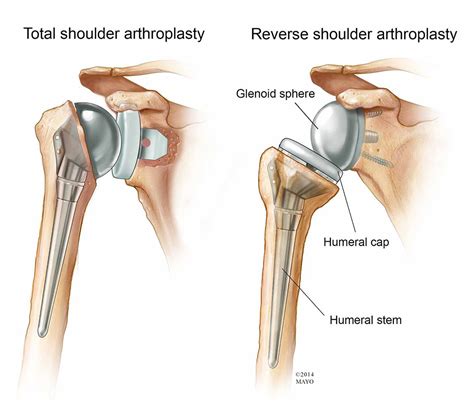 Medical Apparatus Imaging Guide: joint arthroplasty