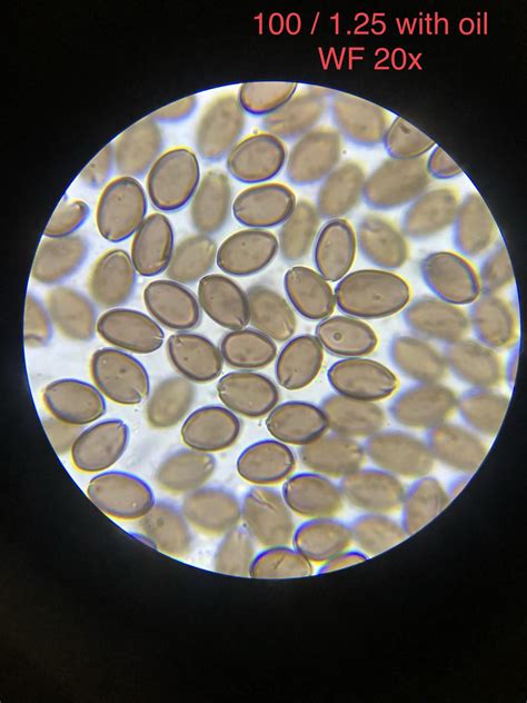 How To Study Magic Mushrooms and Spores Using A Microscope — Canadian Spores