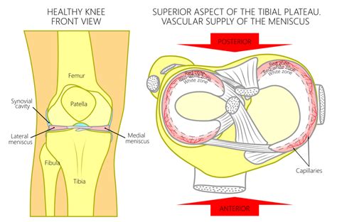 Understanding Knee Pain Caused by Meniscus Injuries - Part 1