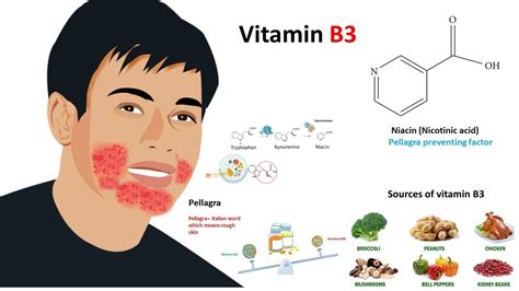 Vitamin B3 : Niacin (sources,metabolism and deficiency) - YouTube