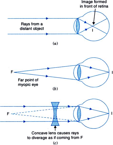 [DIAGRAM] Welding Defects Diagram - MYDIAGRAM.ONLINE