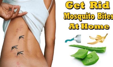 9 Home Remedies for Mosquito Bites-Stop Itching Fast