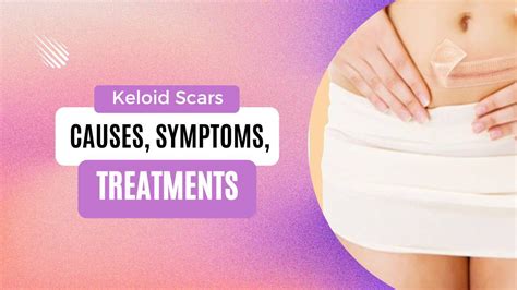 Keloid Scars: Causes, Symptoms, and Treatment Options - Skin Beauty Blog