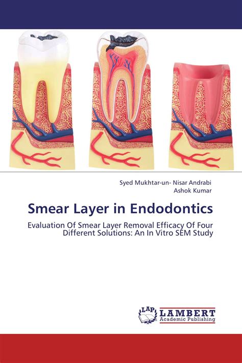 Smear Layer in Endodontics / 978-3-659-11803-6 / 9783659118036 / 3659118036