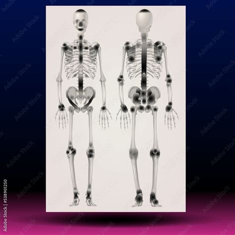 X-ray illustration of a human skeleton - Fla source file available - X ...