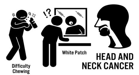 7 common symptoms of head and neck cancer - Read Health Related Blogs ...