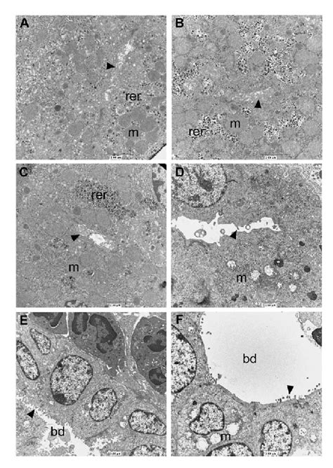 Transmission electron microscopy of bile canaliculi and small bile... | Download Scientific Diagram