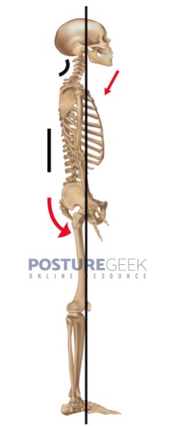 How To Know You Have Flat Back Posture | PostureGeek.com