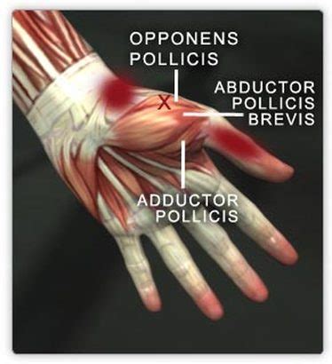 Abductor Pollicis Brevis Muscle - Anatomy of Hand / The csp was ...