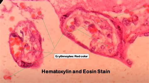 H&E Staining:Introduction,Principle,Test Requirement,Procedure, Result-