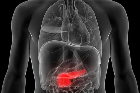 Acute Pancreatitis | Causes, Symptoms, Diagnosis and Treatments