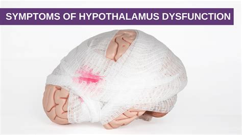 Symptoms of Hypothalamus Dysfunction - Genesis Gold