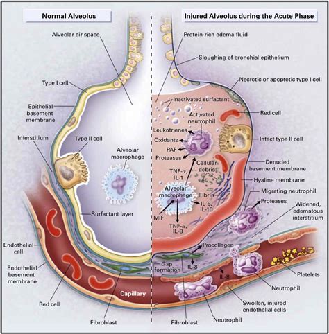 Figure 1 from Seeger Mechanisms of alveolar protein clearance in ...