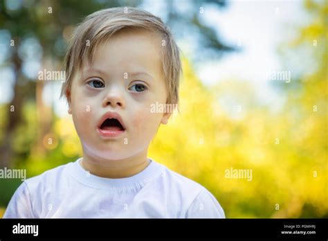 Portrait of Cute small boy with Down syndrome playing in summer day ...