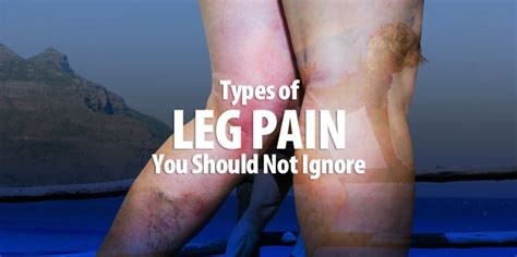 Types of Leg Pain You Should Not Ignore!