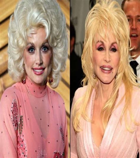 20 Of The Worst Celebrity Plastic Surgery Disasters