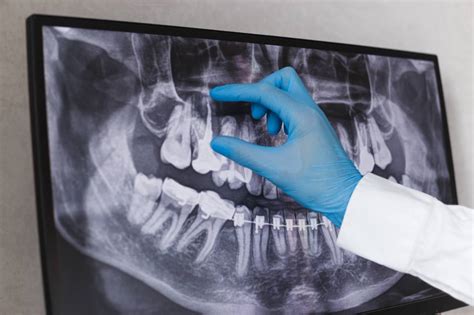 Different Types Of Oral Surgery - Eastern Virginia OMS