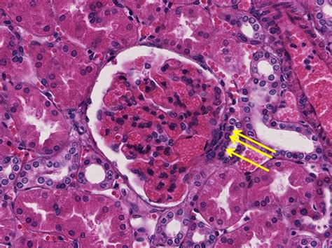 Renal Pyramid Histology