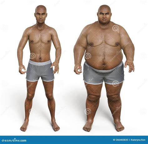 Obese Man before and after Gaining Weight, 3D Illustration. Concept of ...