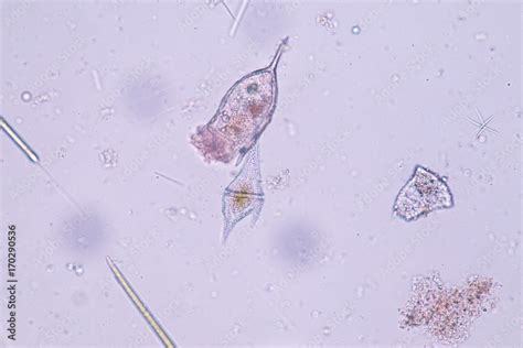 Ceratium/Dinoflagellate (Protozoa) under microscope. Stock Photo ...