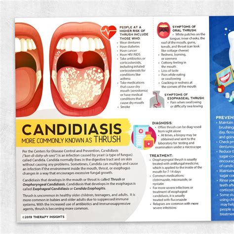 Oral Candidiasis Oral Thrush Causes Pathophysiology Signs Symptoms ...