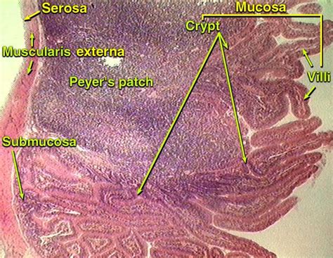 Histology Of Ileum Peyers Patches