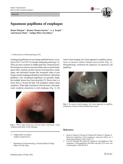 (PDF) Squamous papilloma of esophagus