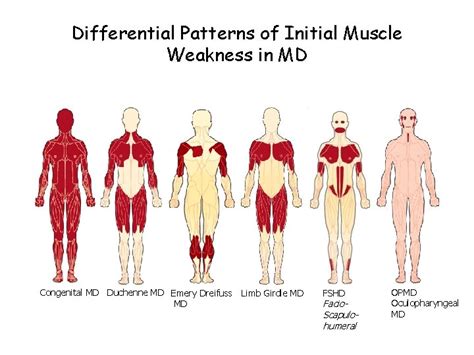 Muscular Dystrophy