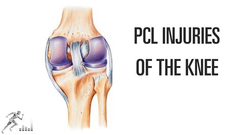 PCL injury of the knee: Mechanism of injury and treatment options - YouTube