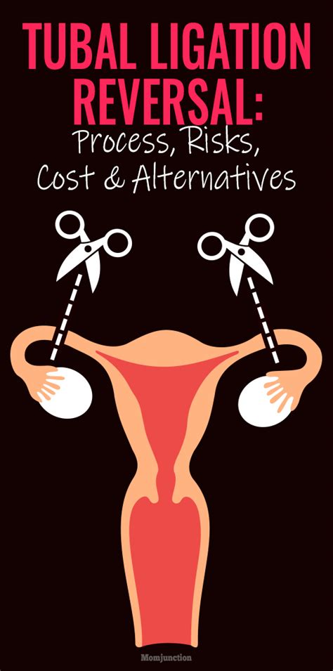 Tubal Ligation Reversal: Process, Risks, Cost And Alternatives