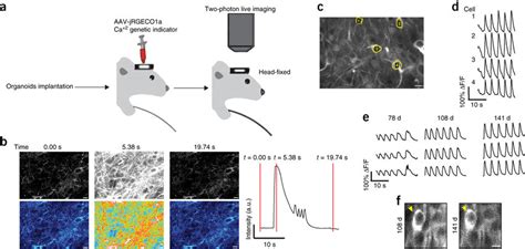 Two-photon imaging reveals neuronal activity in the graft (a ...