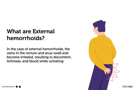 Internal Hemorrhoids Symptoms Hemorrhoids Diagnosis