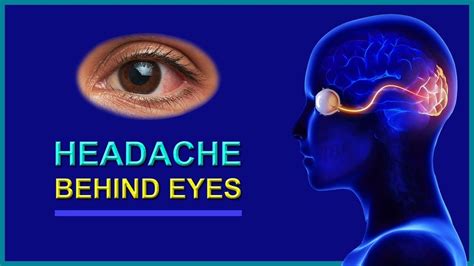 What Is A Headache Behind The Eyes Caused By - Beth Mulholland Bruidstaart