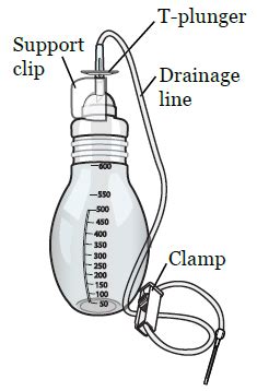 About Your PleurX™ Catheter | Memorial Sloan Kettering Cancer Center