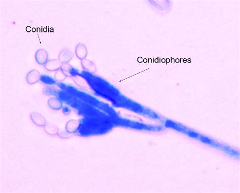 Penicillium Conidia Labeled