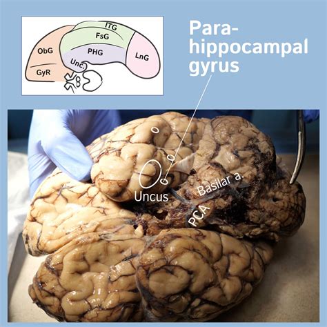 Parahippocampal Gyrus Anatomy