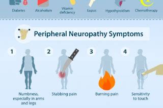 Idiopathic Neuropathy - A Personal Account | Neuropathy and HIV