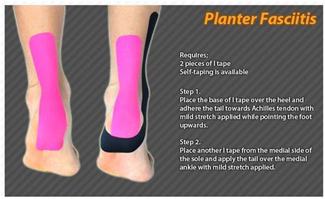 Pin on Kinesiology Tape: Ares