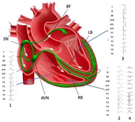 Sheep Heart Anatomy Moderator Band