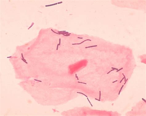 Lactobacillus acidophilus - Wikispecies