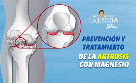 ¿Artrosis y desgaste articular? Encuentra alivio en el magnesio