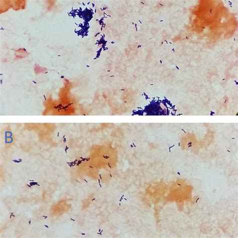 Gram stain of blood culture specimen showing Grampositive rods A: View ...