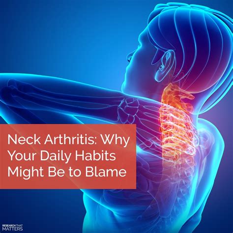 Neck Arthritis: Why Your Daily Habits Might Be to Blame - Sundial Clinics