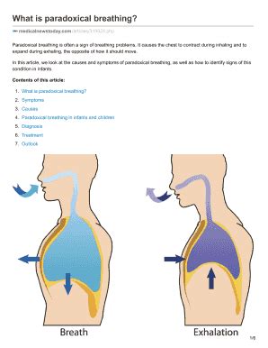 What Is Paradoxical Breathing - Fill and Sign Printable Template Online