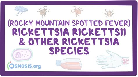 Rickettsia rickettsii & other Rickettsia species - an Osmosis Preview ...