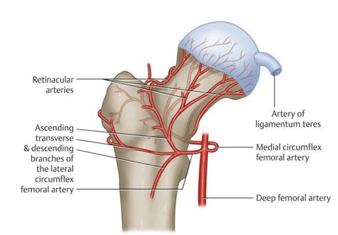 Femoral Neck Stress Fractures - Knee & Sports - Orthobullets